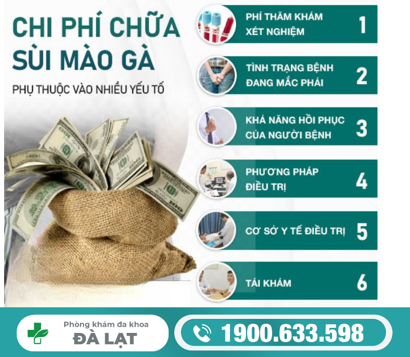Hình ảnh minh họa